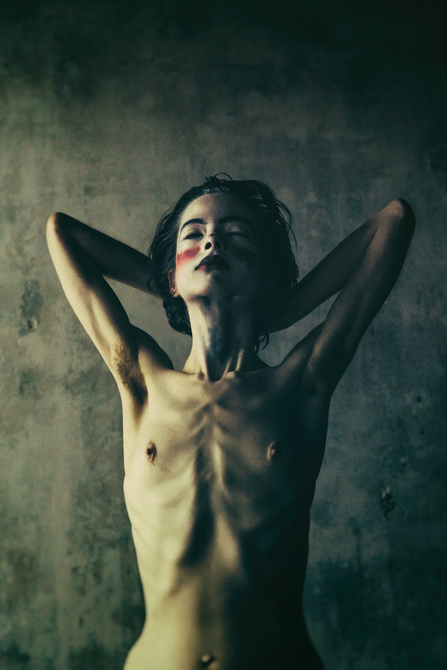 Naked anorexic girls