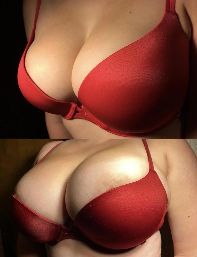 Breasts of women